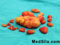 Жировик